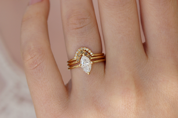 В Турции турист проглотил кольцо с бриллиантом, чтобы украсть его