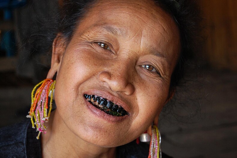 Черные зубы, лишний вес и пластина в губе: самые странные эталоны красоты у женщин