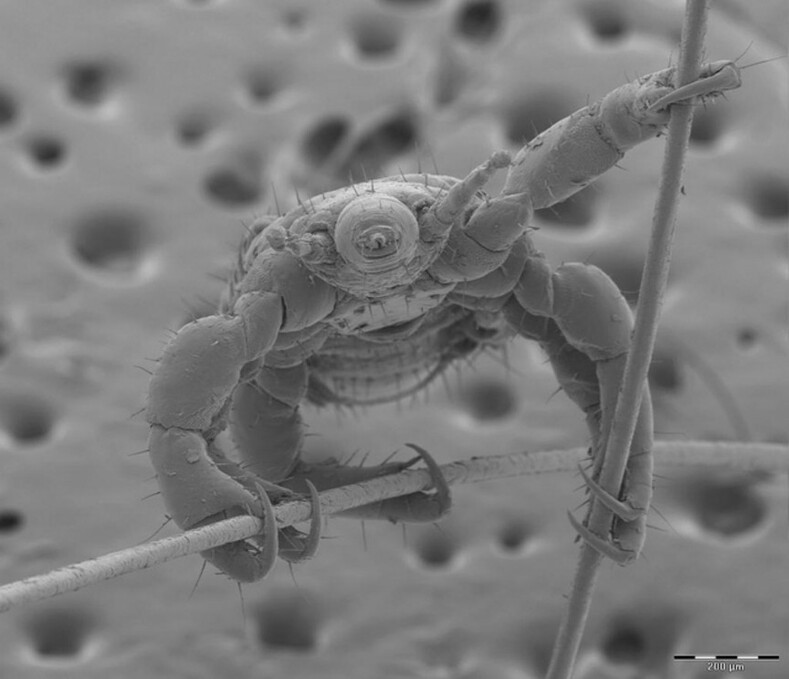 Удивительная красота микроскопических насекомых, недоступная человеческому глазу