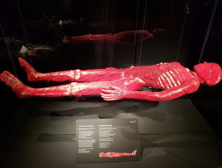 Музей человеческого тела MeMu