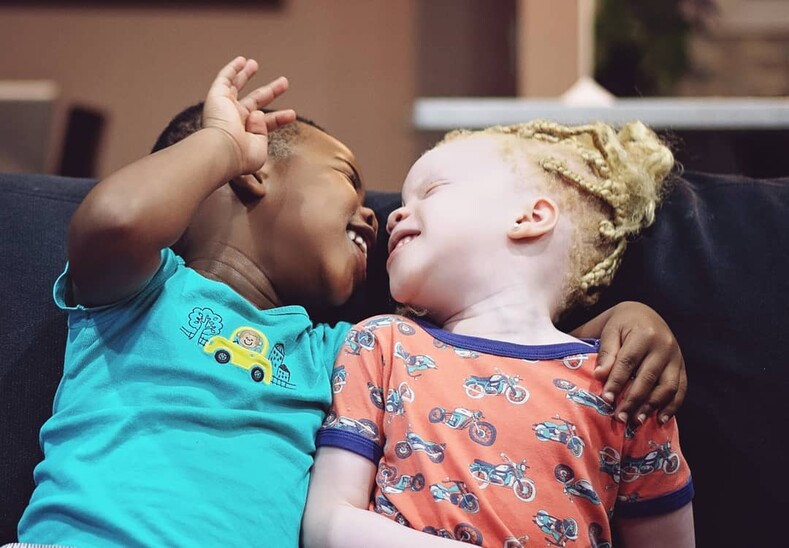 Близнецы с разным цветом кожи: в роддоме мать из Нигерии подумала, что ей дают чужого ребенка