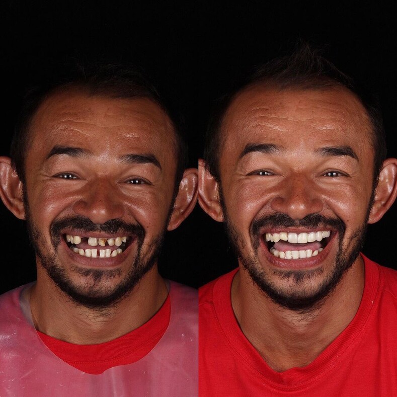 Дантист из Бразилии возвращает красивые улыбки людям, которые не могут оплатить операции