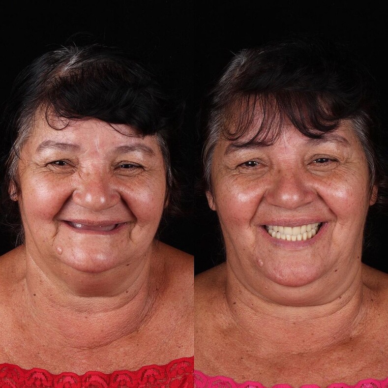 Дантист из Бразилии возвращает красивые улыбки людям, которые не могут оплатить операции