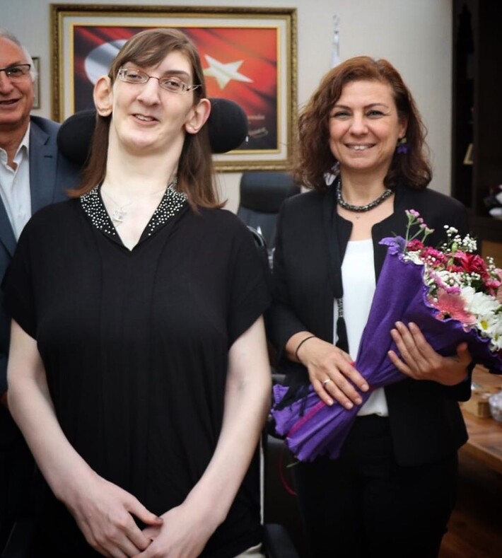 Рекордсменка Гиннеса: как живет 24-летняя турчанка, ставшая самой высокой женщиной в мире из ныне живущих